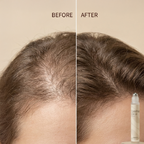 Lumina Grow Hair Growth Serum Roll-On — Micro-Channel Delivery™ System
