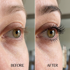 Lumina Grow Hair Growth Serum Roll-On — Micro-Channel Delivery™ System
